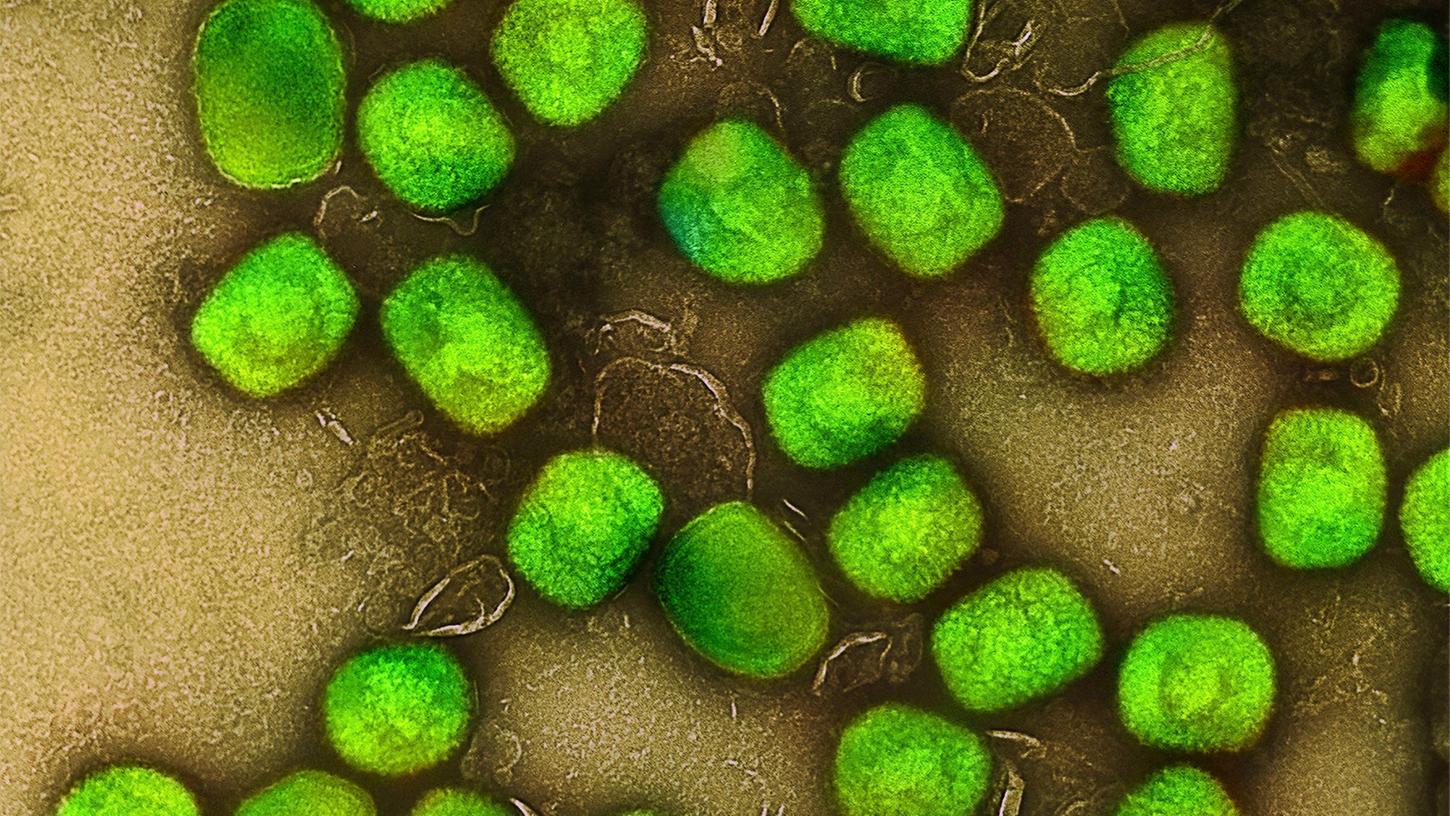 Eine kolorierte ektronenmikroskopische Aufnahme von Partikeln des Affenpockenvirus. Angesichts der steigenden Affenpocken-Nachweise hat die Weltgesundheitsorganisation (WHO) erstmals konkrete Empfehlungen für das Sexualverhalten gegeben. Eine kolorierte ektronenmikroskopische Aufnahme von Partikeln des Affenpockenvirus. Angesichts der steigenden Affenpocken-Nachweise hat die Weltgesundheitsorganisation (WHO) erstmals konkrete Empfehlungen für das Sexualverhalten gegeben.