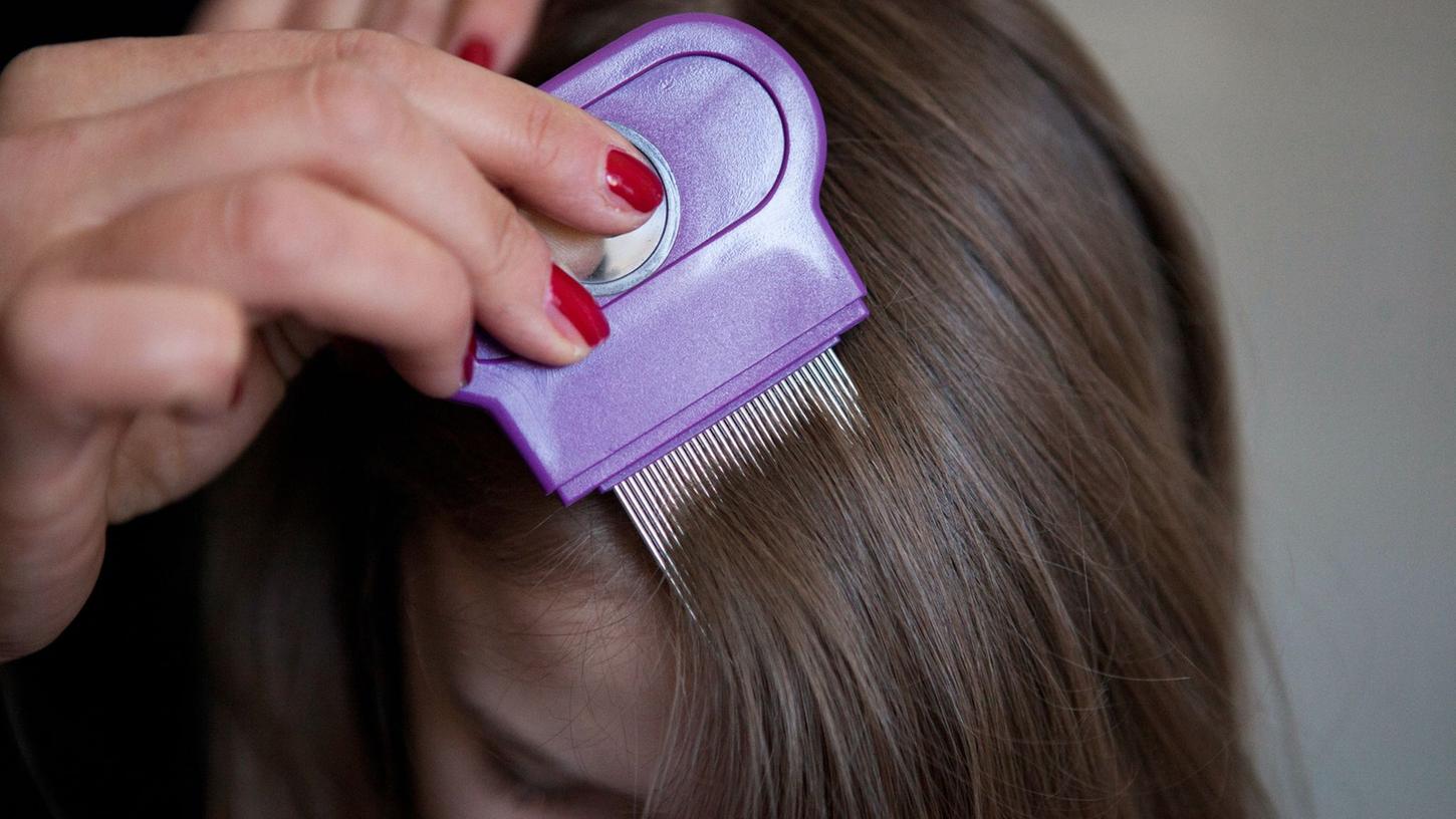 Kopfläuse sind nicht gefährlich, aber unangenehm. Los wird man sie mit Läusemittel aus der Apotheke und einem Kamm mit feinen Zinken. Kopfläuse sind nicht gefährlich, aber unangenehm. Los wird man sie mit Läusemittel aus der Apotheke und einem Kamm mit feinen Zinken.