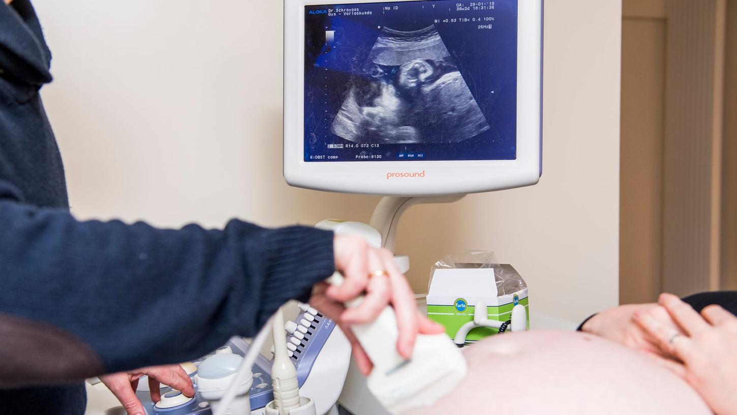 Ein Arzt untersucht eine schwangere Frau mit einem Ultraschallgerät während der Fötus im Mutterbauch auf einem Display zu sehen ist.