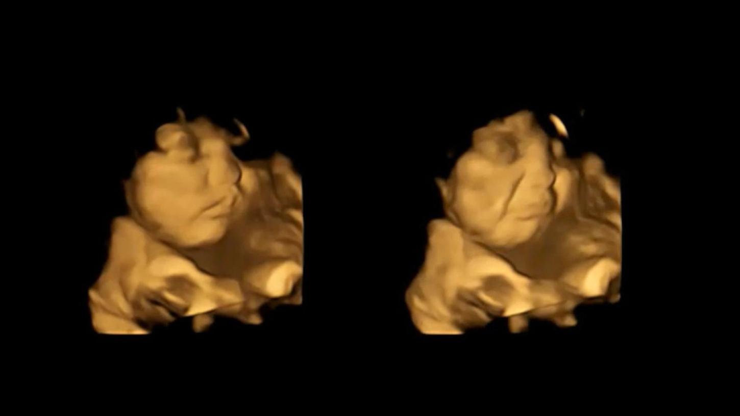 Bereits im Mutterleib reagieren Babys positiv oder negativ auf manche Lebensmittel, wie die Wissenschaftler der nordostenglischen Universität Durham herausfanden. Bereits im Mutterleib reagieren Babys positiv oder negativ auf manche Lebensmittel, wie die Wissenschaftler der nordostenglischen Universität Durham herausfanden.