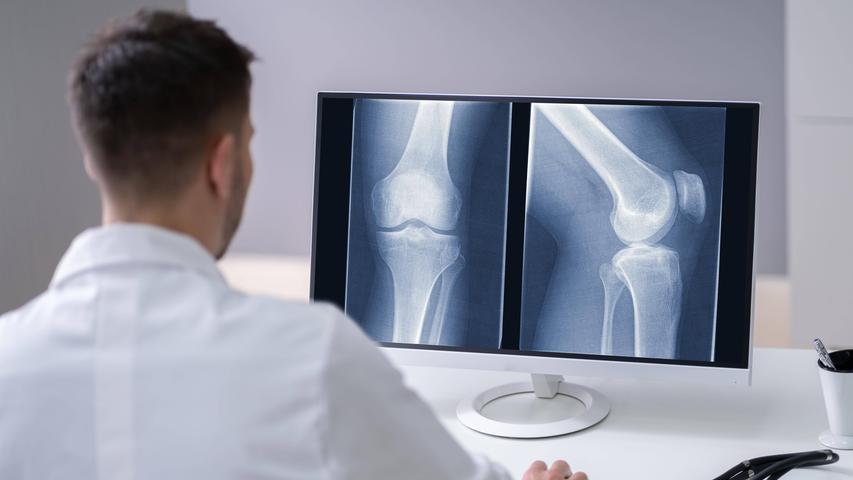 Klinikcheck 2022: Knieschmerzen - wann Sie ein künstliches Kniegelenk brauchen Klinikcheck 2022: Knieschmerzen - wann Sie ein künstliches Kniegelenk brauchen
