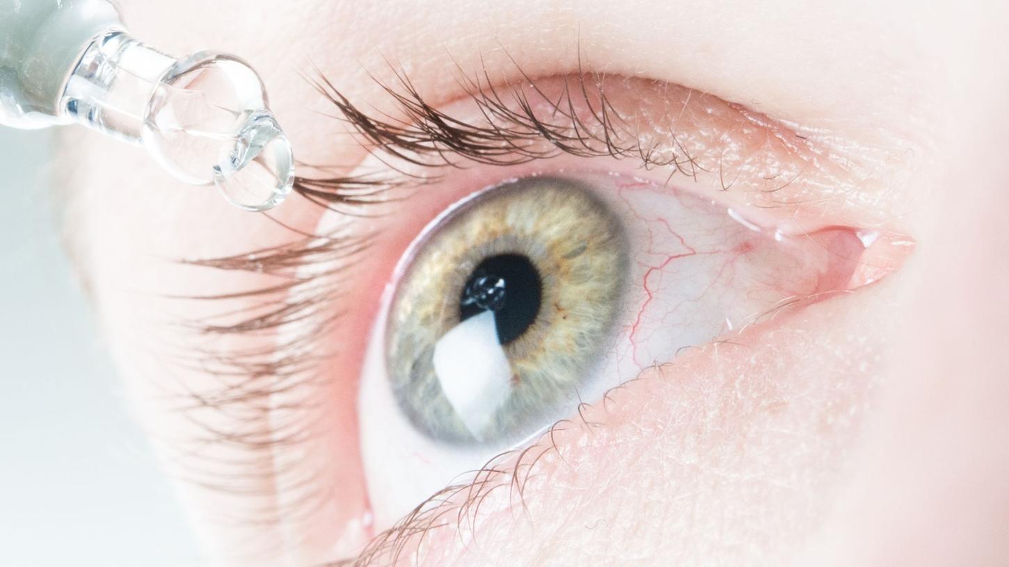 Das Auge ist von feinen Blutgefäßen durchzogen. Dass da mal eines platzt und für ein blutrotes Auge sorgt, lässt sich kaum vermeiden.