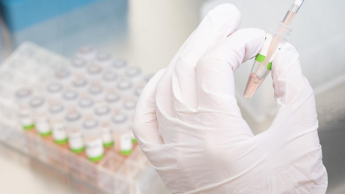 Eine biologisch-technische Assistentin bereitet PCR-Tests für die Analyse vor.