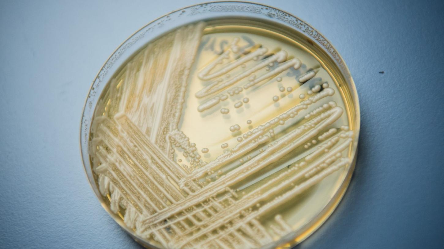 Der Hefepilz Candida auris in einer Petrischale. Die Weltgesundheitsorganisation (WHO) ist besorgt über 19 kranheitserregende Pilze, die nach Expertenansicht die öffentliche Gesundheit bedrohen.