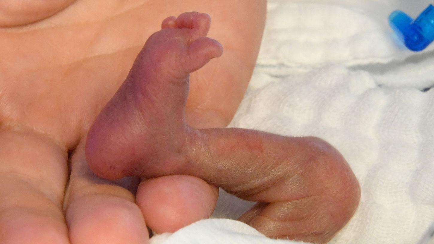 Der direkte Hautkontakt von Frühchen und Mutter bzw. Betreuungsperson noch vor dem Brutkasten kann einen positiven Einfluss auf die Entwicklung der Kinder haben.