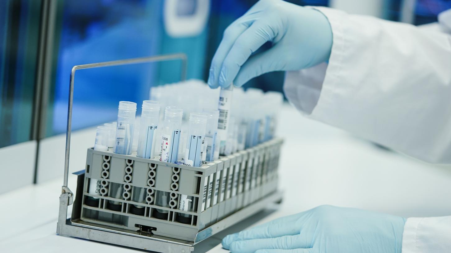 Ein Mitarbeiter eines Coronatest-Labors hält PCR-Teströhrchen in den Händen. (Symbolbild)