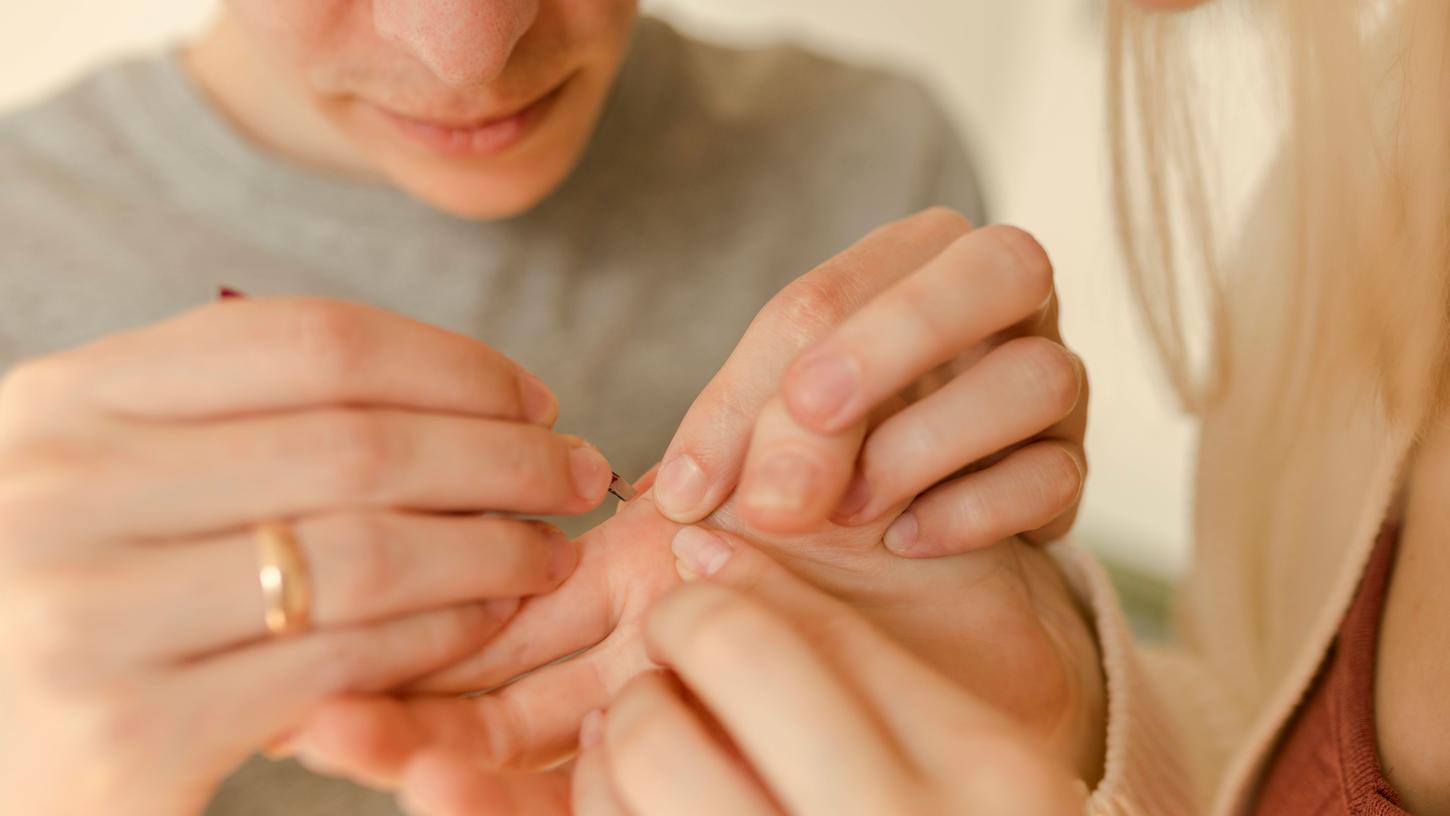 Hier erfahren Sie, wie Sie Splitter entfernen können und welche Hausmittel dabei helfen. Hier erfahren Sie, wie Sie Splitter entfernen können und welche Hausmittel dabei helfen.