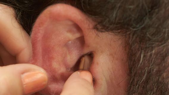 Studie: Hörgeräte können ältere Menschen vor Demenz bewahren