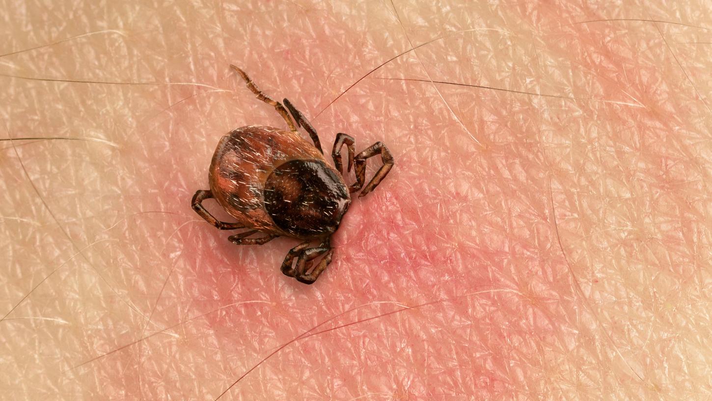 Hat sich der kleine Parasit erst einmal festgebissen, hilft nur noch Pinzette oder Zeckenkarte. Dr. Martin Seitz sieht das gründliche Absuchen, nachdem man in der Natur war, als einzig nützliche Vorbeugung. Hat sich der kleine Parasit erst einmal festgebissen, hilft nur noch Pinzette oder Zeckenkarte. Dr. Martin Seitz sieht das gründliche Absuchen, nachdem man in der Natur war, als einzig nützliche Vorbeugung.