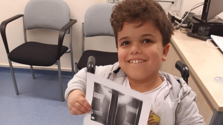 OPs und Behörden-Streit: Wie der neunjährige Milo aus Franken für ein normales Leben kämpft