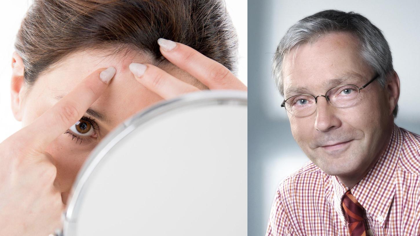 Auf keinen Fall selbst ausquetschen, rät Professor Michael Sticherling, stellvertretender Direktor der Hautklinik des Universitätsklinikums Erlangen. Auf keinen Fall selbst ausquetschen, rät Professor Michael Sticherling, stellvertretender Direktor der Hautklinik des Universitätsklinikums Erlangen.