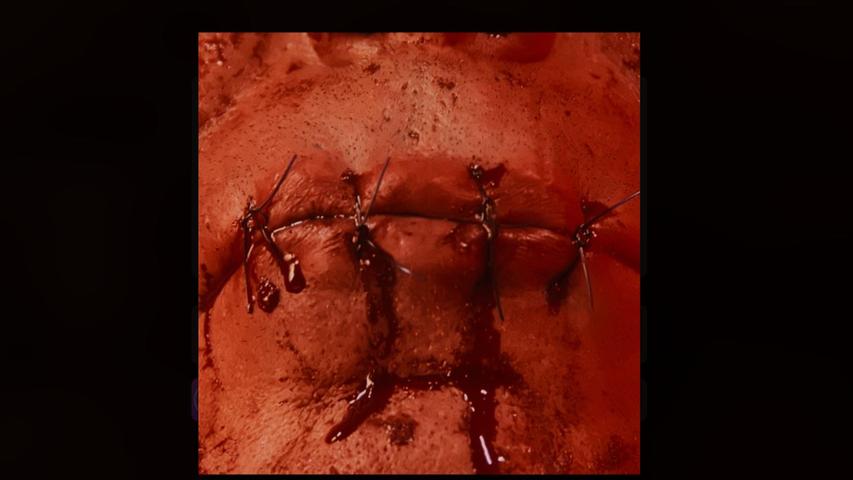 Der Mund ist zugenäht. So zeigt sich Till Lindemann in seinem Video zu "Zunge". 