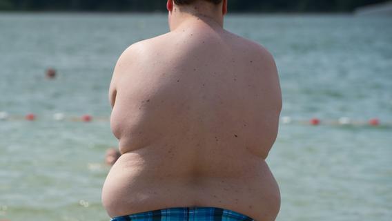 250-Kilo-Mann aus dem Nürnberger Land ist fettsüchtig: "Es ist heftig, ich habe permanent Hunger"