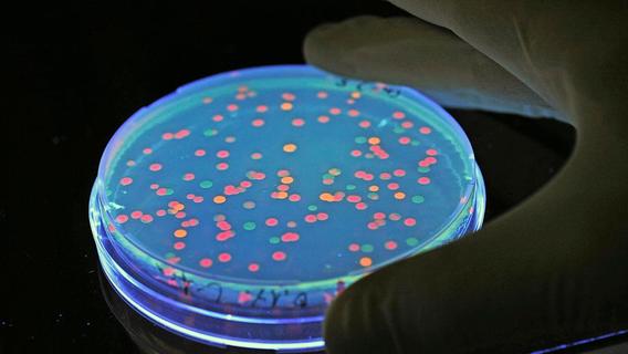 Wegen Salmonellengefahr: Hersteller ruft beliebtes Bio-Produkt zurück – und warnt vor Verzehr