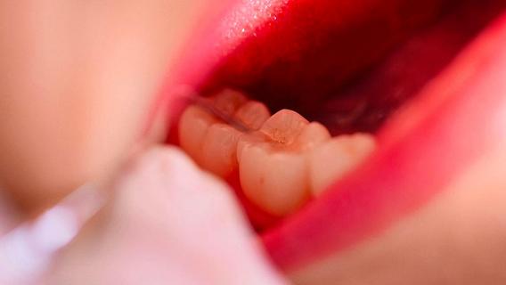 Zahnarzt bohrt versehentlich Schraube in Gehirn von Patient
