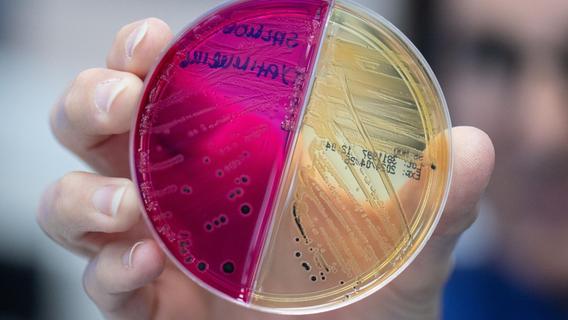 Detektivarbeit am Darm-Mikrobiom: Was Stuhlproben verraten