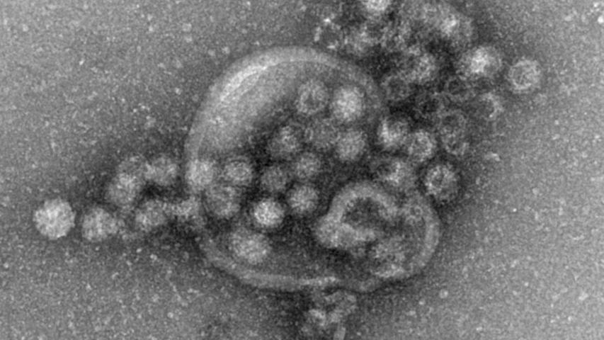 Das hochansteckende Norovirus verursacht einen plötzlich auftretenden, heftigen Brechdurchfall.