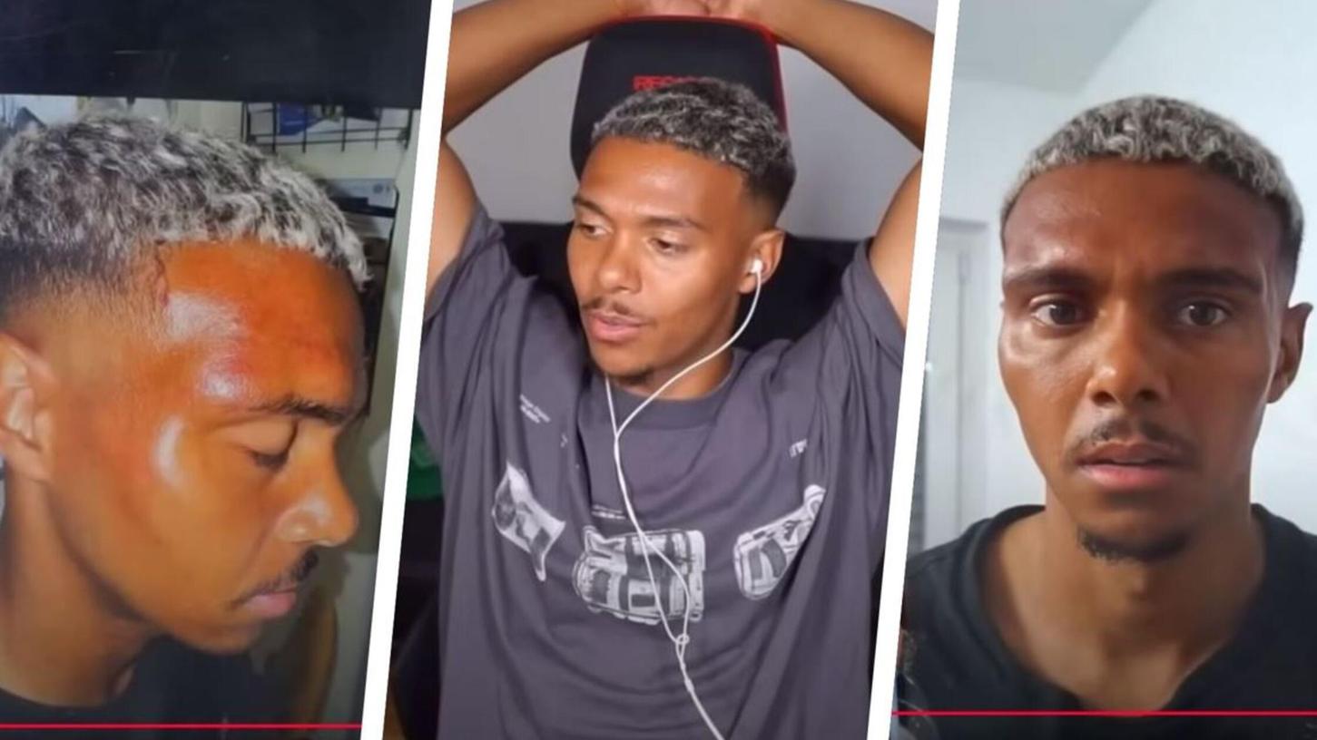 FCN-Spieler "Willy" Sommer äußert sich erstmals zu der brutalen Prügelattacke, die er von den eigenen "Fans" erleiden musste. FCN-Spieler "Willy" Sommer äußert sich erstmals zu der brutalen Prügelattacke, die er von den eigenen "Fans" erleiden musste.