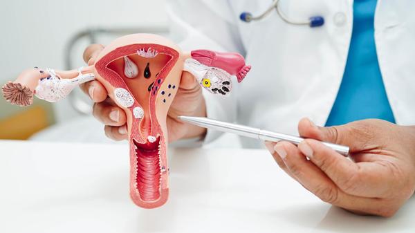 Uterus, doctor holding human anatomy model for stu