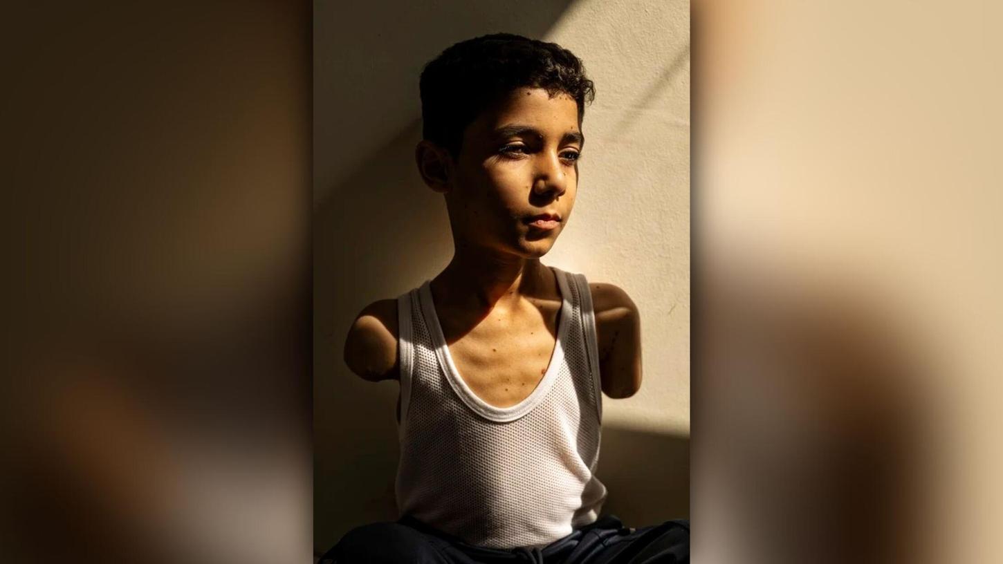 Dieses von „World Press Photo“ herausgegebene Foto zeigt Mahmoud Ajjour (9), der während des Gaza-Kriegs von einer Rakete eines israelischen Kampfflugzeugs getroffen wurde und beide Arme verlor. Dieses von „World Press Photo“ herausgegebene Foto zeigt Mahmoud Ajjour (9), der während des Gaza-Kriegs von einer Rakete eines israelischen Kampfflugzeugs getroffen wurde und beide Arme verlor.