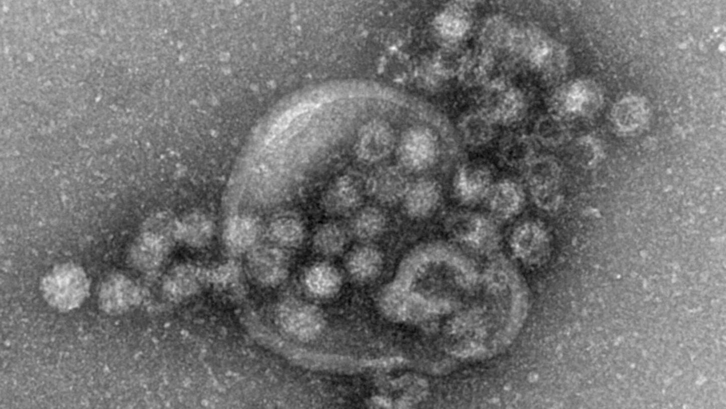 Das Norovirus ist sehr leicht übertragbar und gehört zu den weltweit häufigsten Erregern für plötzlich auftretenden Brechdurchfall. Das Norovirus ist sehr leicht übertragbar und gehört zu den weltweit häufigsten Erregern für plötzlich auftretenden Brechdurchfall.