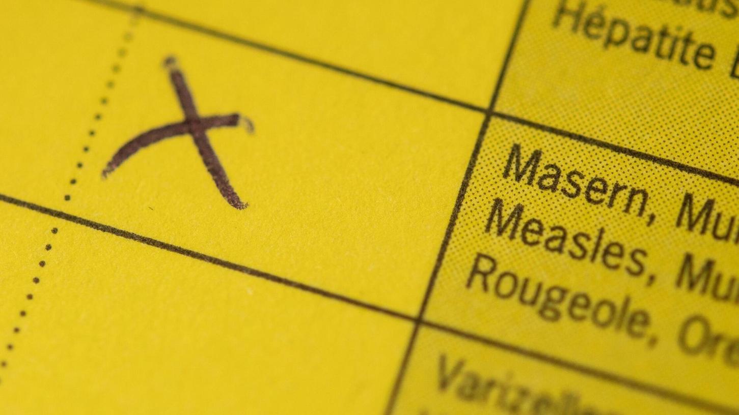 Im Landkreis Freyung-Grafenau gibt es aktuell sechs Masernfälle. (Symbolbild) Im Landkreis Freyung-Grafenau gibt es aktuell sechs Masernfälle. (Symbolbild)