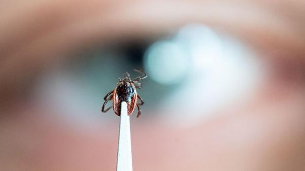 Frau hält eine Zecke auf einer Pinzette7406.jpg