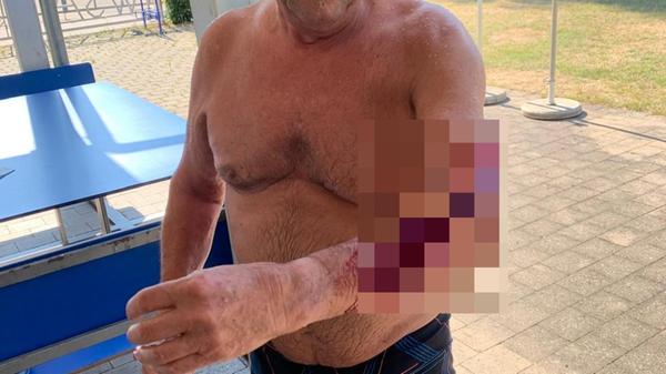 Wallerbiss Absberg Walter Schock