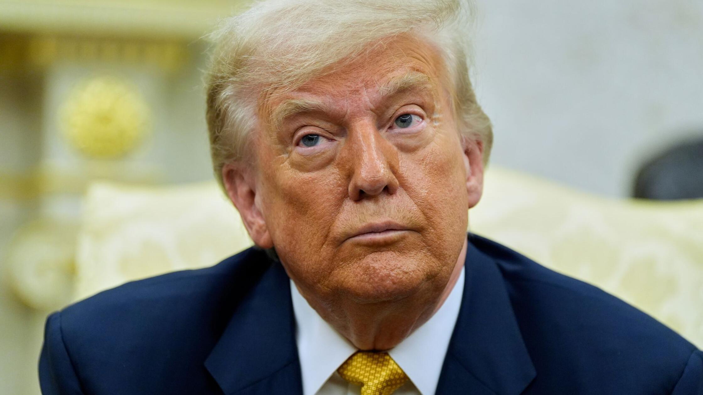 Wei&szlig;es Haus gibt Entwarnung nach Bluterg&uuml;ssen an H&auml;nden: Trump hat chronisch ven&ouml;se Insuffizienz