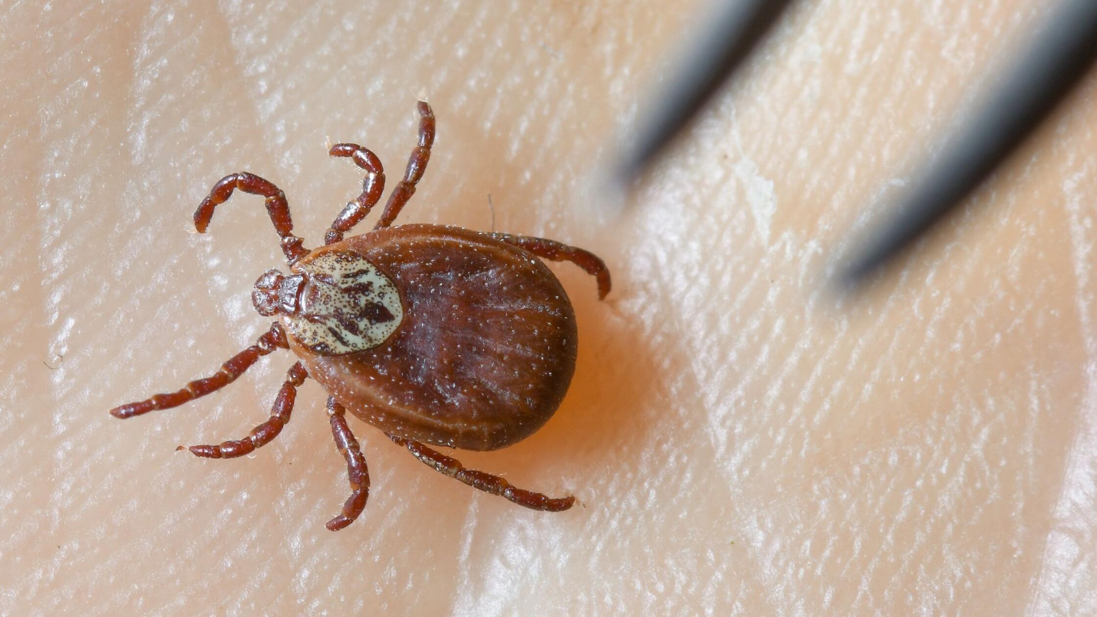 Borreliose-Fälle nach Zecken-Stichen nehmen zu