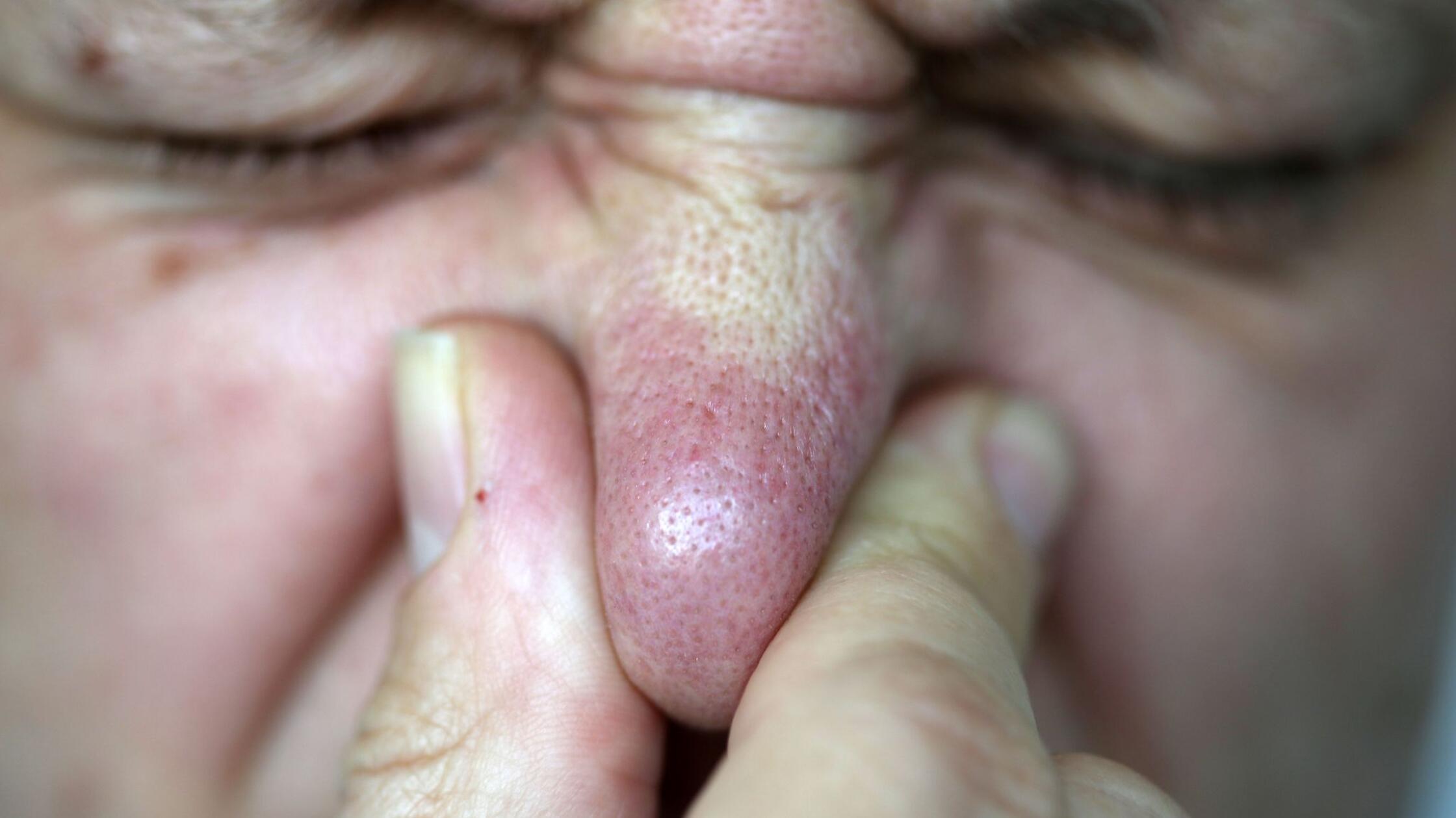 Dicke Luft im Flieger: Das Pups-Problem