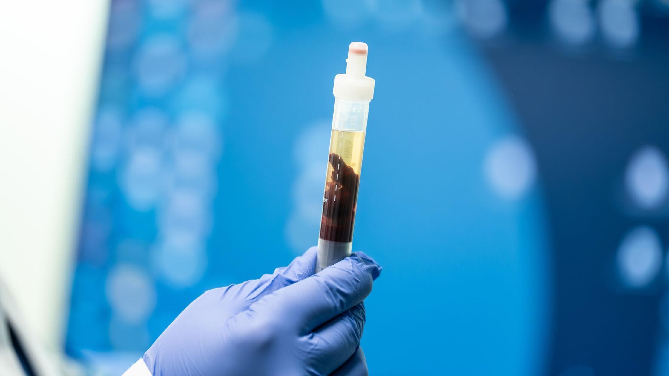 Pestinfektion in Kalifornien nachgewiesen