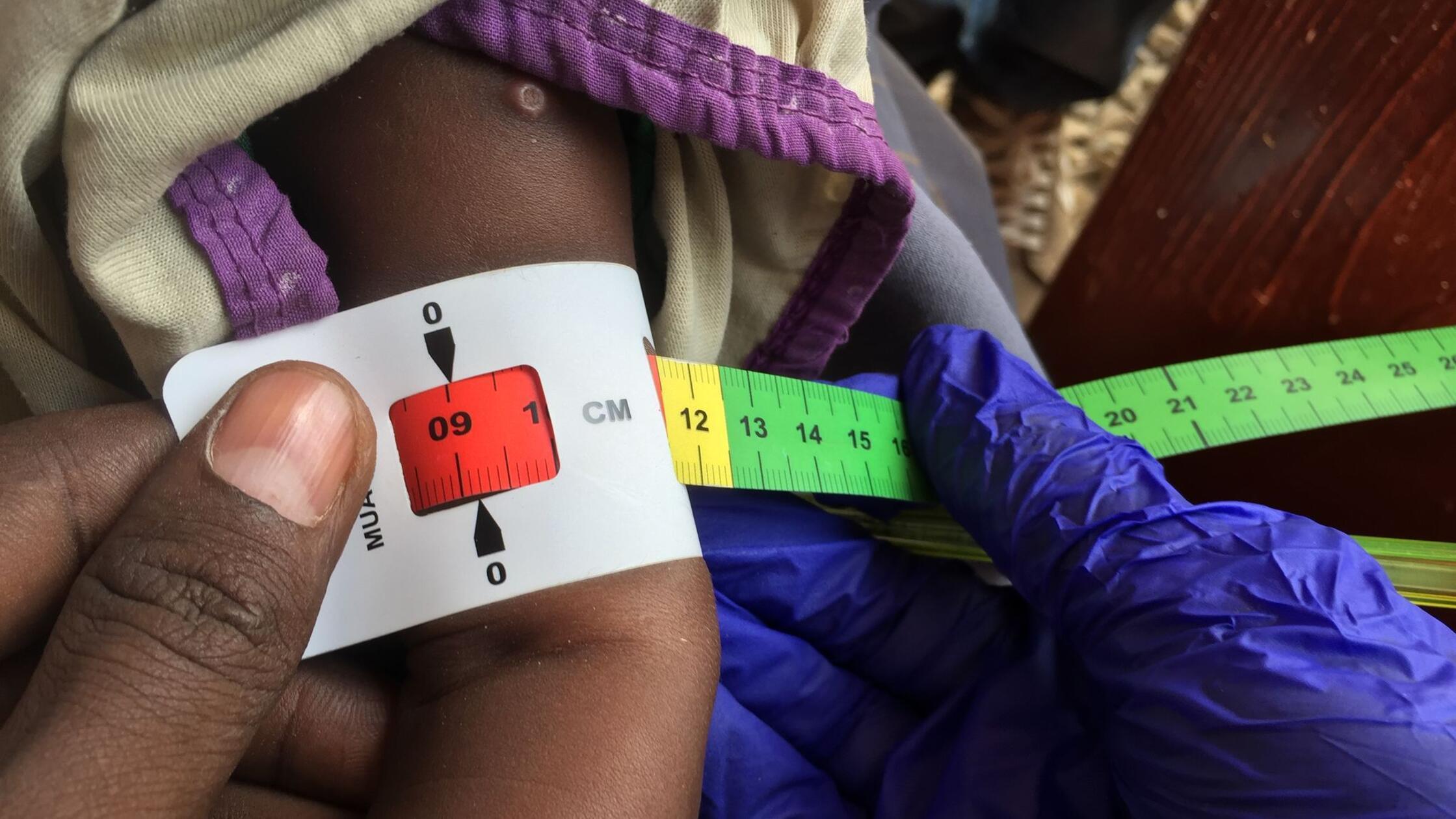 Unicef: Belagerter Ort im Sudan „Epizentrum des Kinderleids“