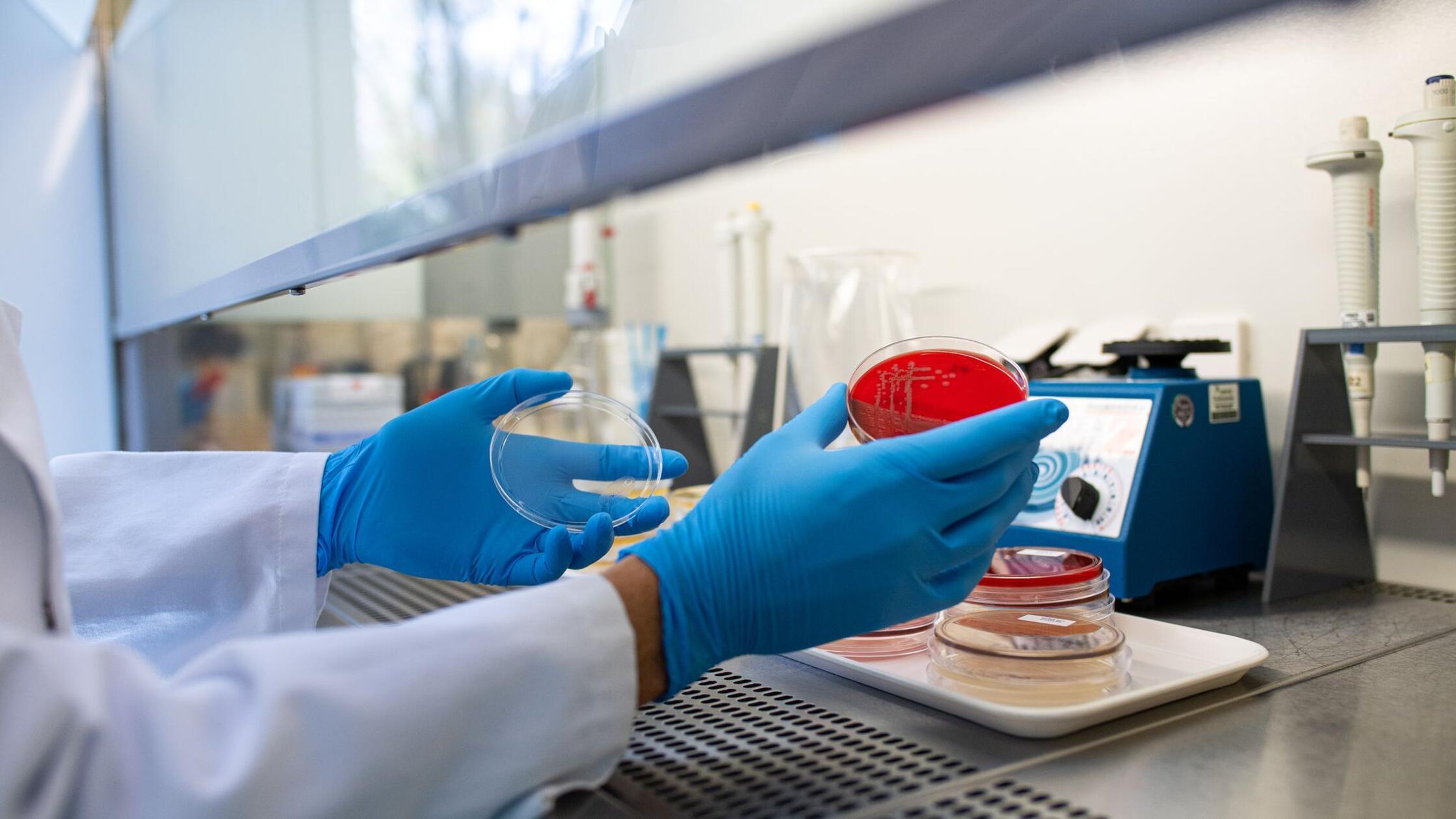 Fünf weitere Ehec-Infektionen in Vorpommern