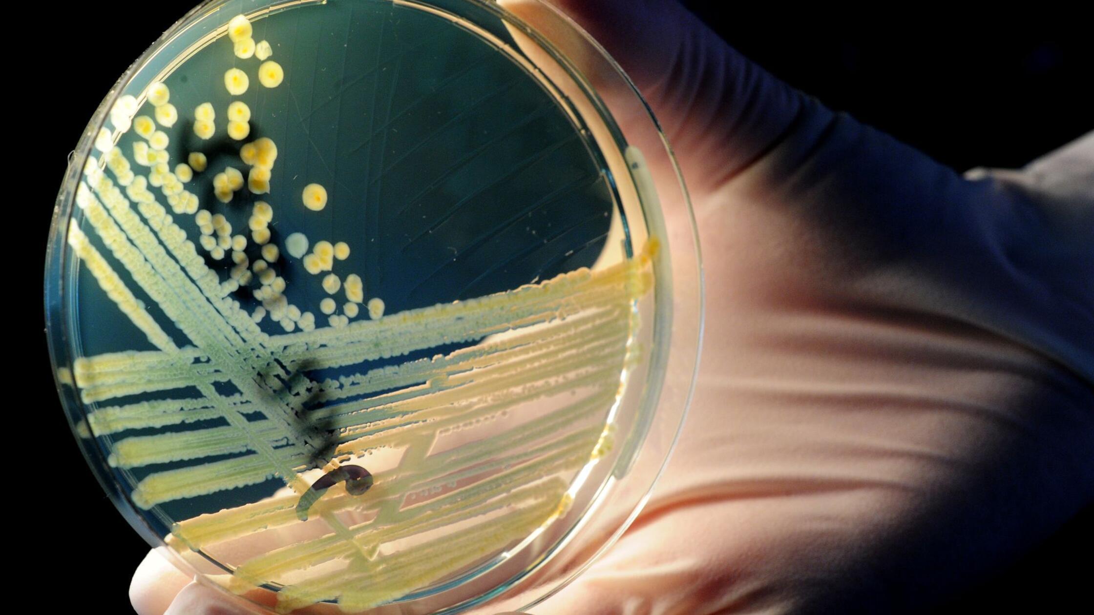 Ehec-Fälle in Vorpommern und Belgien hängen nicht zusammen