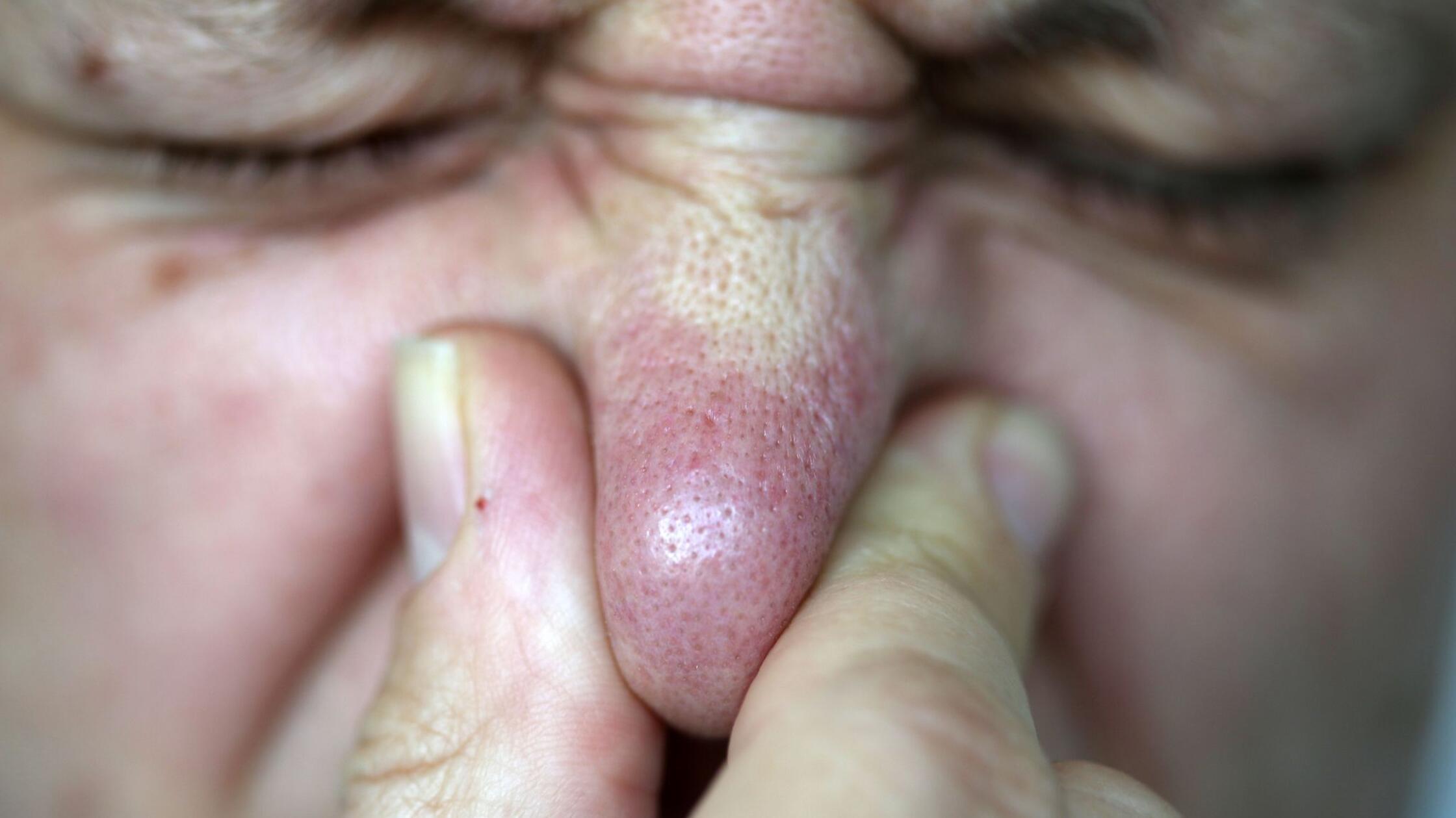 Prebivalce Untermaina že dve leti moti neznosen smrad