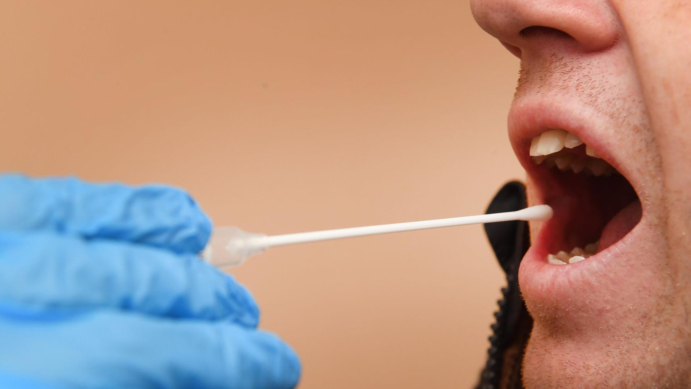 Mann schickt Freund zu Vaterschaftstest - Bewährungsstrafe