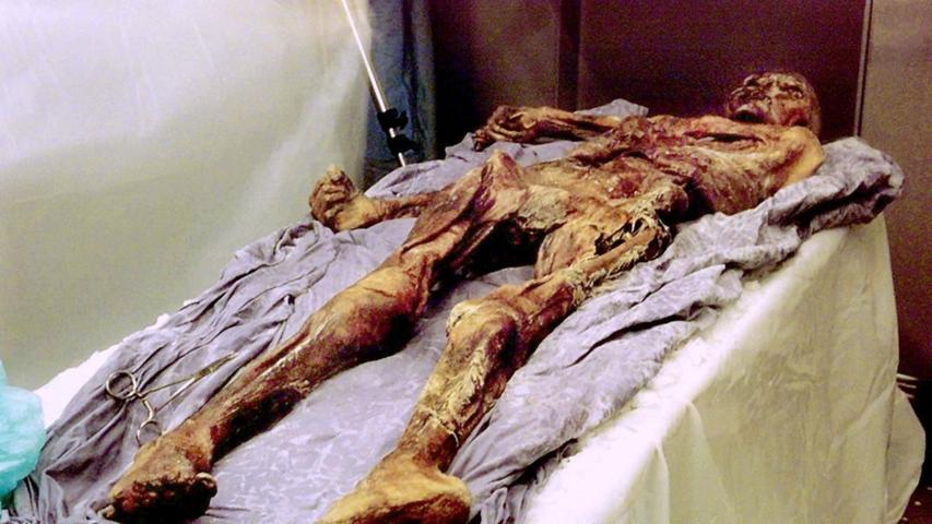 Die 5300 Jahre alte Gletscherleiche "Ötzi" nach ihrer Ankunft im Archäologischen Museum in Bozen. Experten um Albert Zink wollten vor allem die Todesumstände des Steinzeit-Menschen herausfinden.