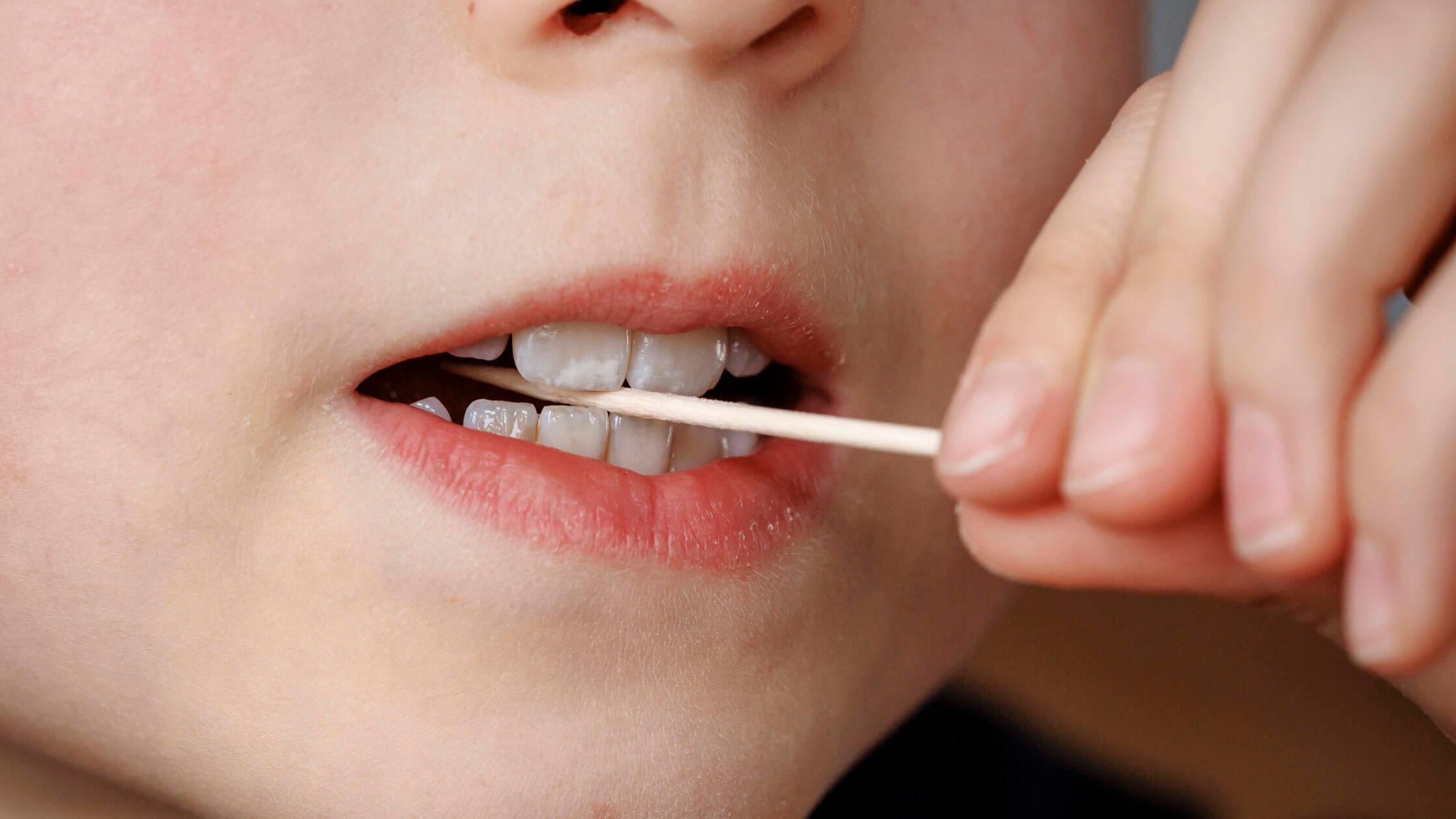 Gef-hrlicher-Zahnstocher-Trend-mit-Geschmack-und-Nikotin-So-reagieren-N-rnbergs-Schulen