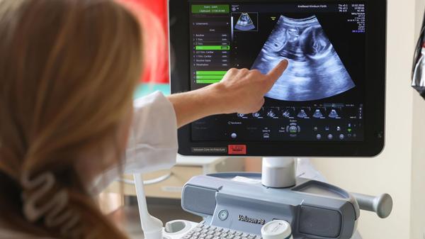 Oberärztin Anja Forster zeigt auf dem Bildschirm b