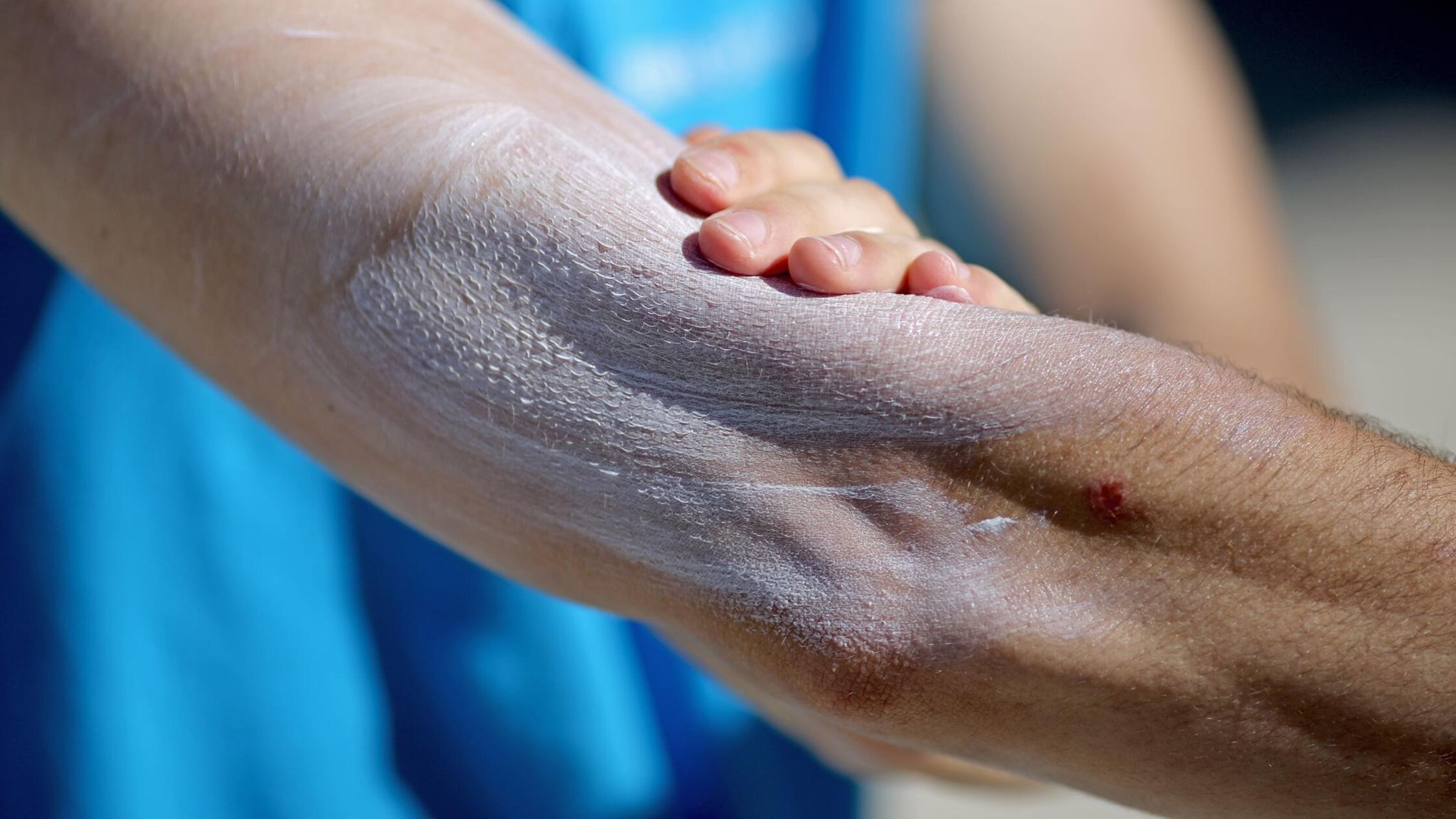 urn:newsml:dpa.com:20090101:240515-99-37442