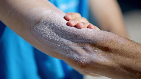 urn:newsml:dpa.com:20090101:240515-99-37442