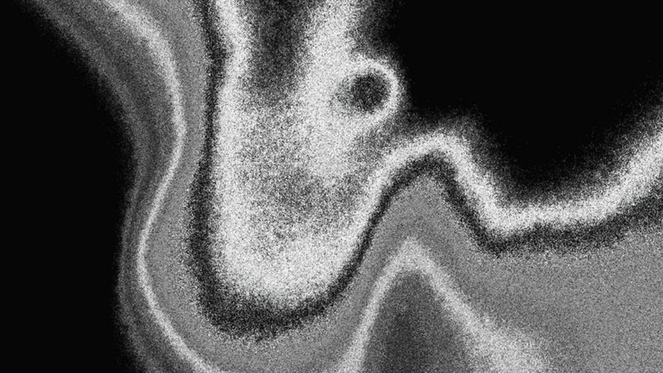 Stefan E. Nollenberg: "post:noise"
Eine Audioinst