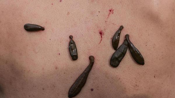 imago0239972481h