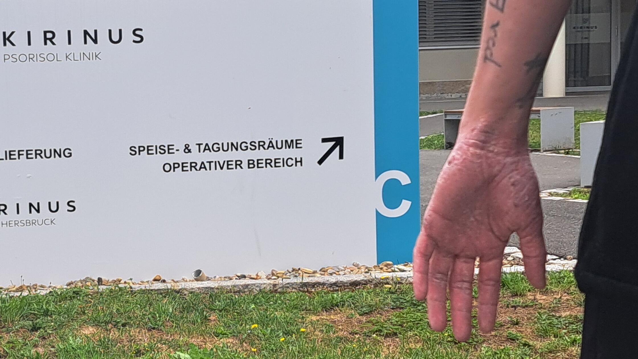 Kirinus Psorisol Clinic Hersbruck: Skin, psyche, and the path to help