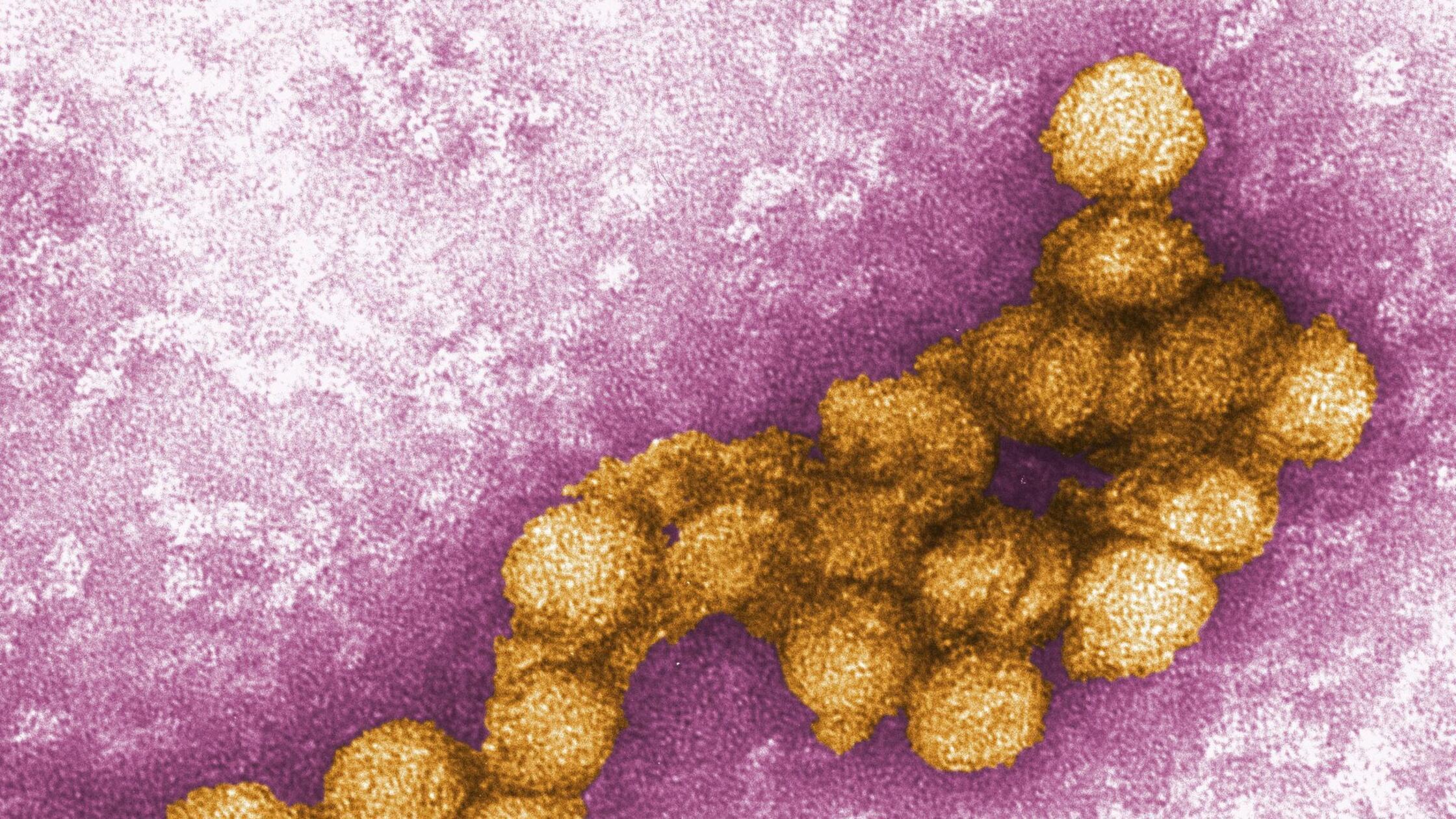 Das West-Nil-Virus unter dem Elektronenmikroskop. 
