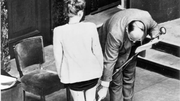 Die polnische Studentin J. Dzido, die im KZ Ravensbrück inhaftiert war, zeigt die Spuren der an ihr vorgenommenen medizinischen Experimente. Die Narben an den Beinen sprechen für sich.