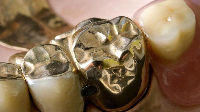 Zahnersatz und Corona-Regelungen: Das ändert sich im Oktober