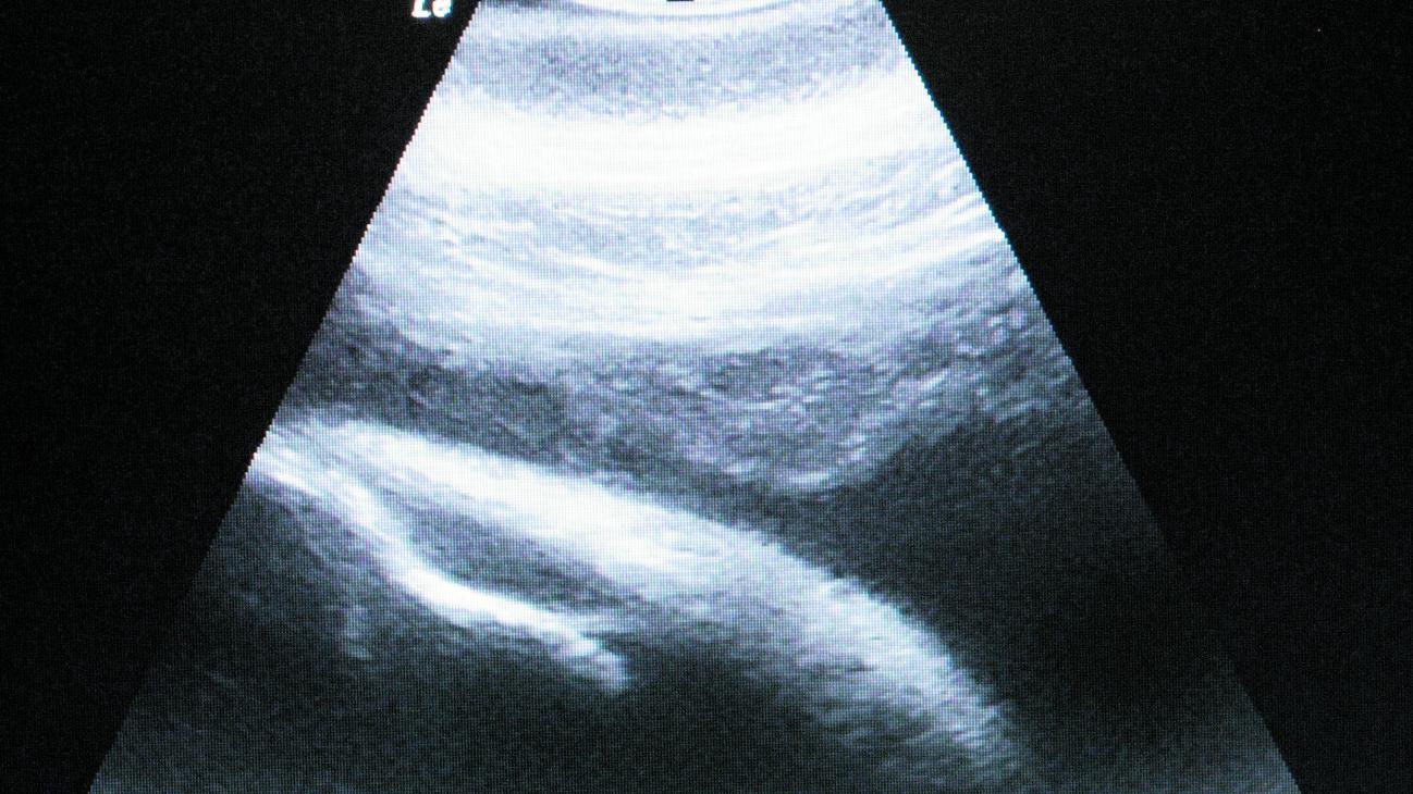 Dieses Ultraschallbild zeigt das Delfinkalb in Sunnys Bauch etwa sechs Wochen vor der Geburt.