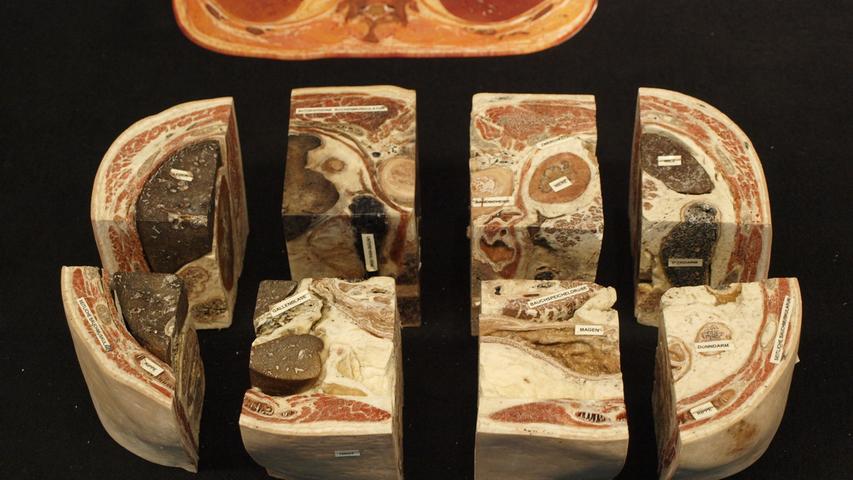 Von Hagens "Körperwelten" sind eine Wanderausstellung, die es seit dem Ende der Neunziger gibt. Schon damals gab es zahlreiche Diskussionen über die Plastinate - menschliche Körper.